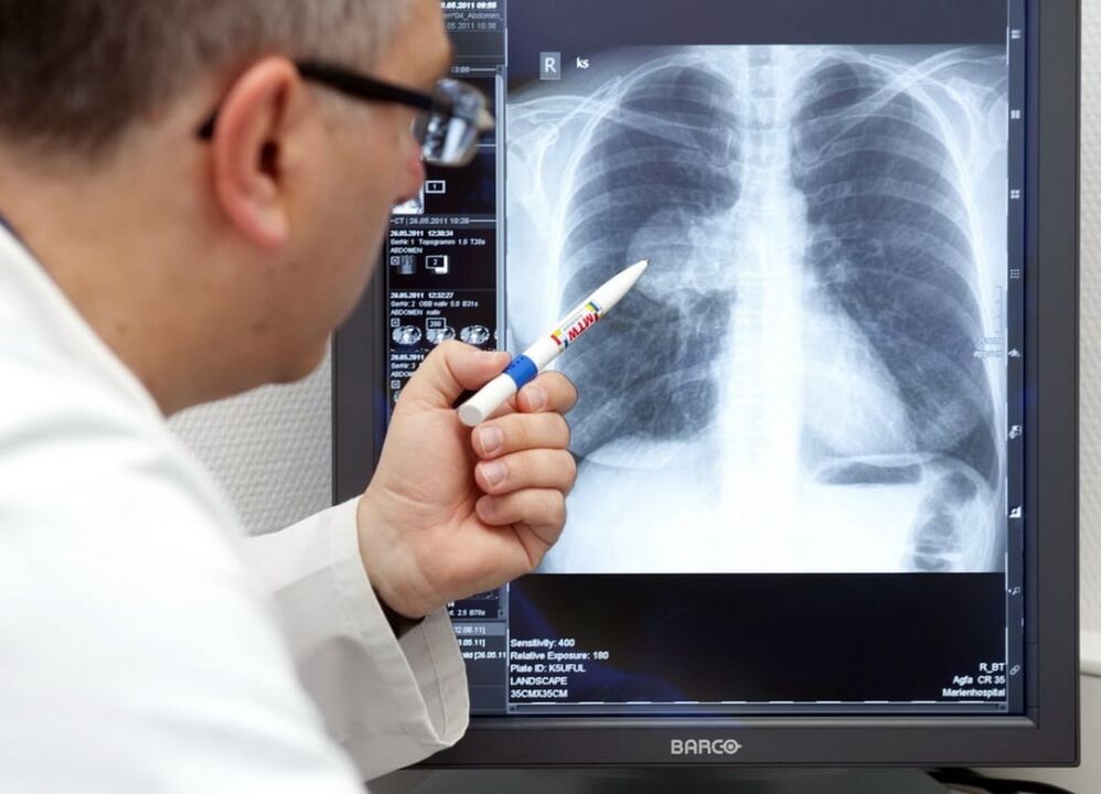 diagnosticul hipertensiunii arteriale